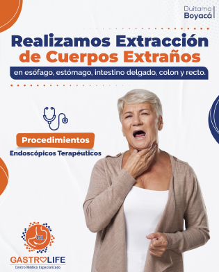 EXTRACCION DE CUERPOS EXTRAÑOS EXTRACCION DE CUERPOS EXTRAÑOS
