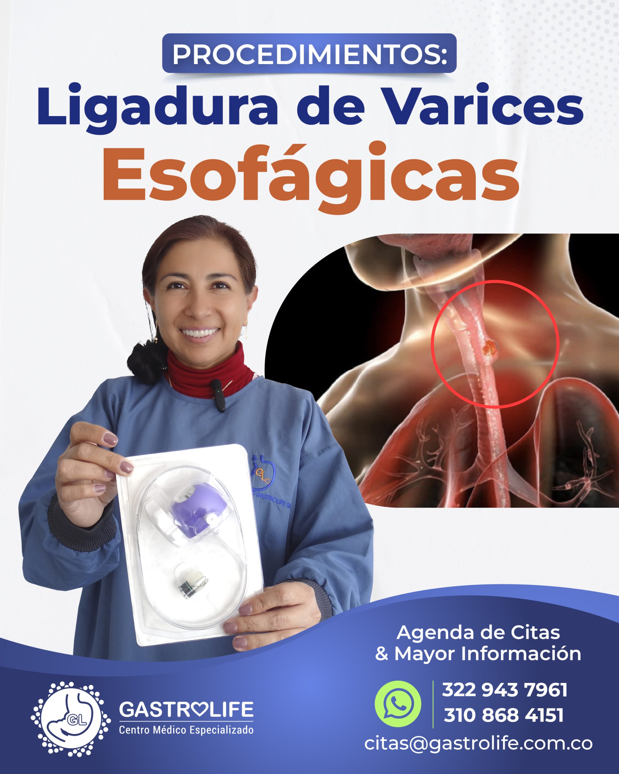 PATM LIGADURA VARICES ESOFAGICAS PATM LIGADURA VARICES ESOFAGICAS